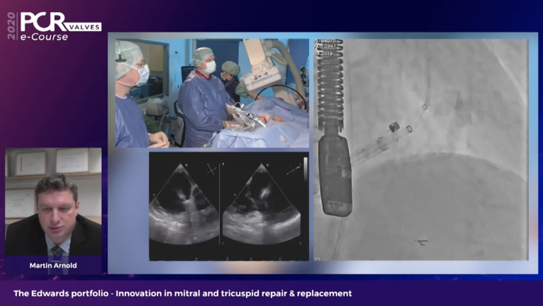 The Edwards portfolio - Innovation in mitral and tricuspid repair & replacement - PCR Valves eCourse