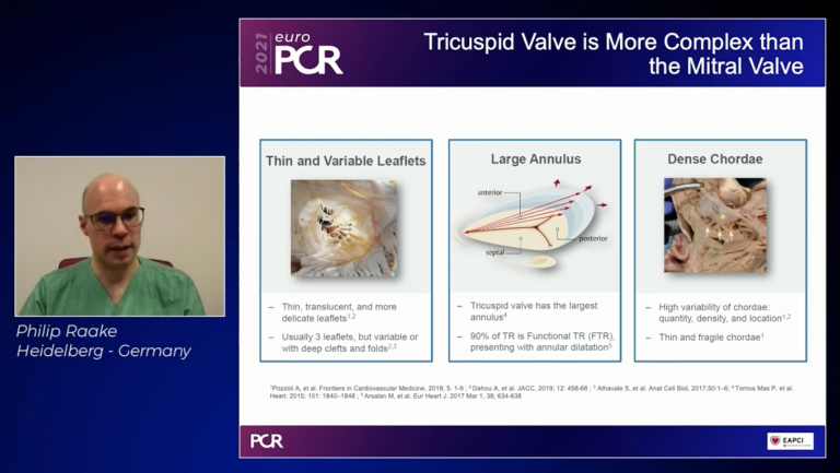 Embrace the future of mitral and tricuspid repair and replacement Youtube video