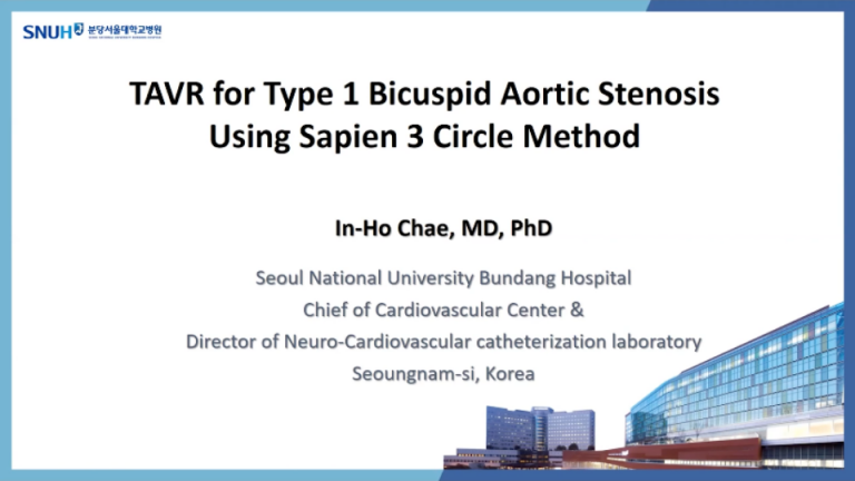 TAVR for Type 1 Bicuspid Aortic Stenosis Using Sapien 3 Circle Method Featured Image