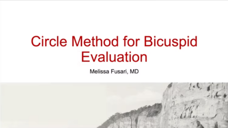 Circle Method for Bicuspid Evaluation Featured Image