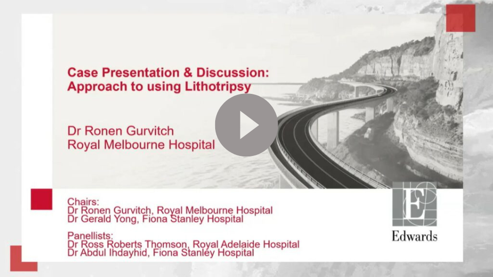 Case Presentation & Discussion: Approach to using Lithotripsy​ Dr Ronen Gurvitch